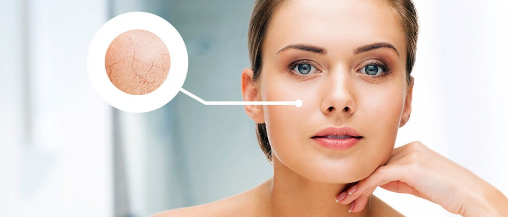 Cải thiện da khô mùa đông bằng xông hơi ướt 